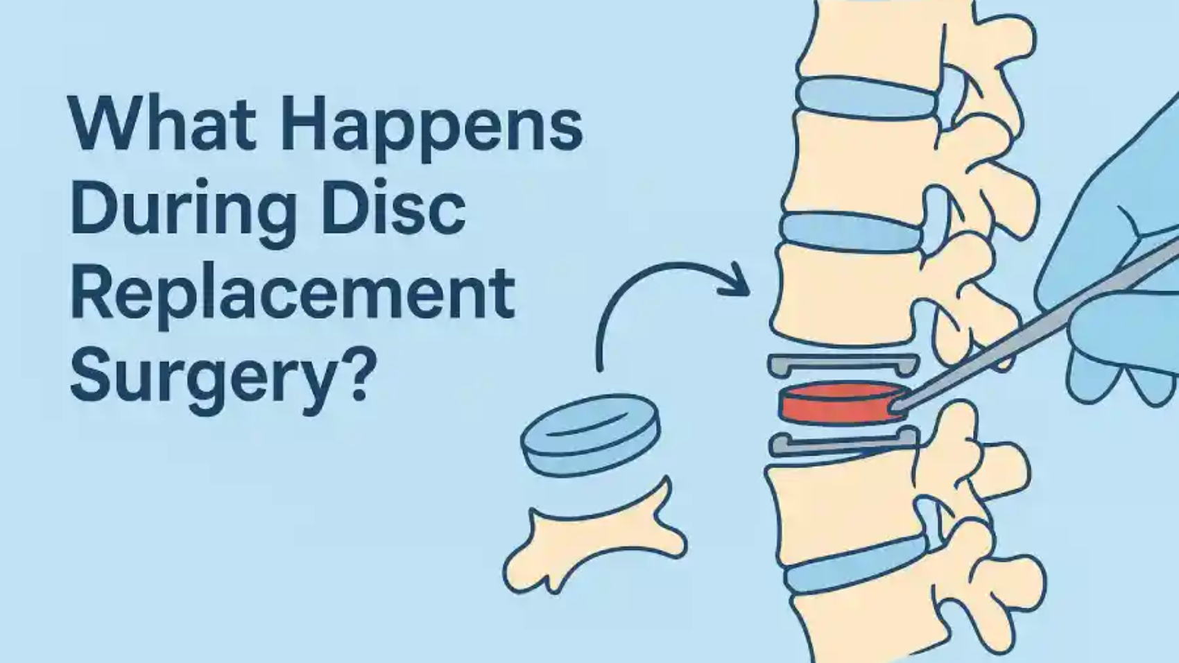 Disc Replacement Surgery