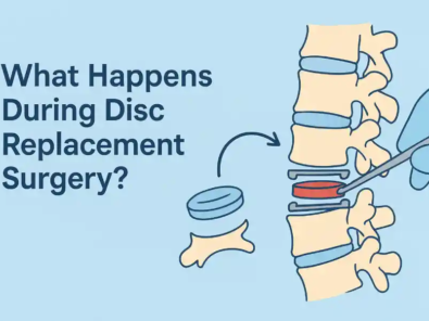 Disc Replacement Surgery
