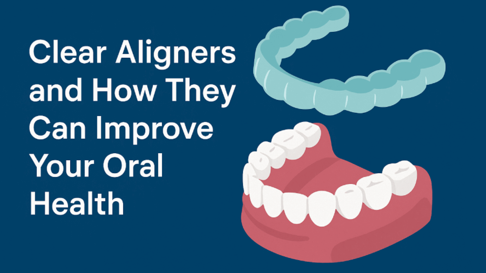 clear aligners