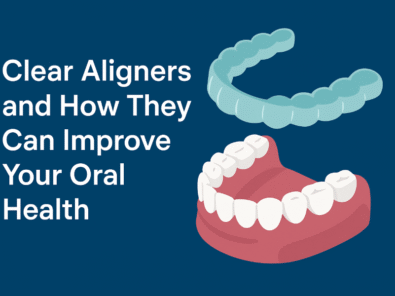 clear aligners